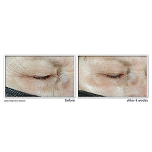 Cargar imagen en el visor de la galería, RoC Multi Correxion Hyaluronic Acid Anti Aging Under Eye Cream for Puffiness &amp; Dark Circles (.5 OZ) + RoC Retinol Capsules (7 CT), Skin Care Routine, Fragrance &amp; Paraben Free for Women and Men