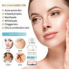 Load image into Gallery viewer, Glossiva Drying Lotion Acne Spot Treatment