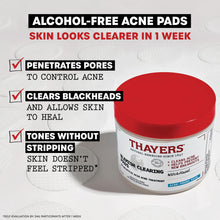 Load image into Gallery viewer, Thayers Blemish Clearing Toner Pads with Salicylic Acid, Soothing Acne Treatment Face Pads, 60 Ct (Packaging May Vary)